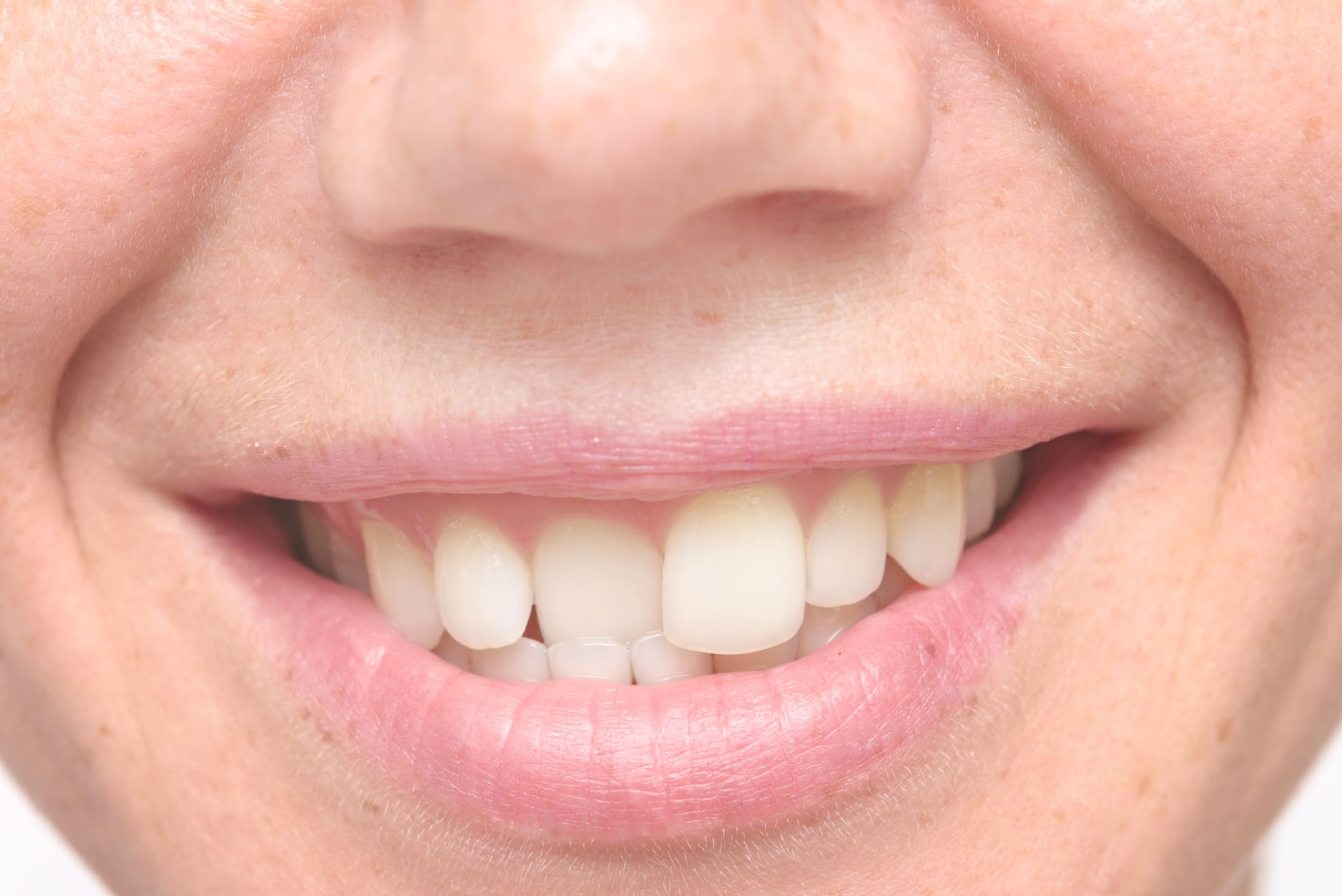 Straighten Crooked Teeth With These 3 Treatments Fox Lake IL