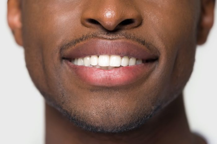 whiter teeth with cosmetic dental treatment