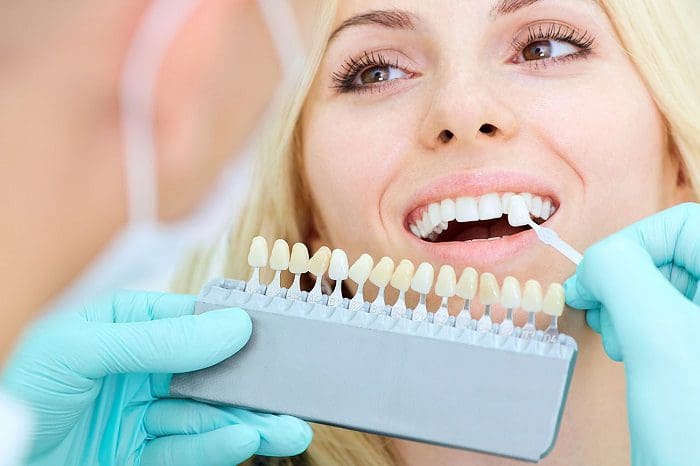 Maximize Porcelain Veneers Effects