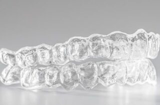 Hygiene Tips for Invisalign