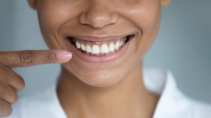 Dangers of Gum Recession