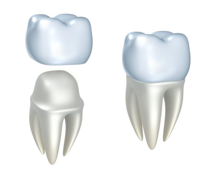 Your dentist may recommend a dental crown for several reasons. Understanding these reasons can help you make informed decisions.