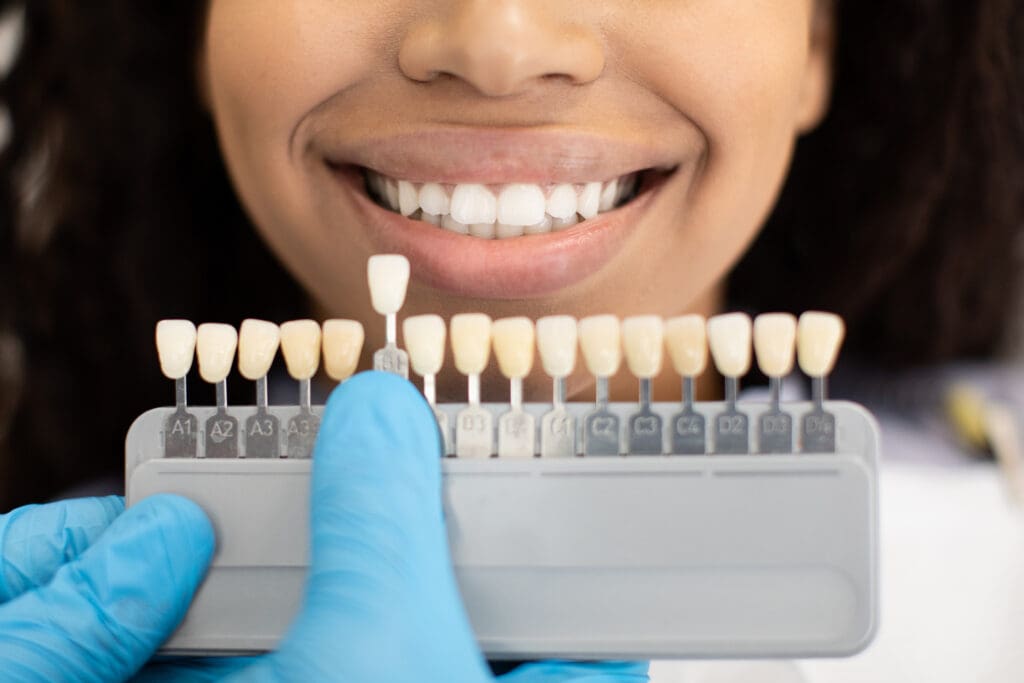 teeth whitening in Fox Lake IL
