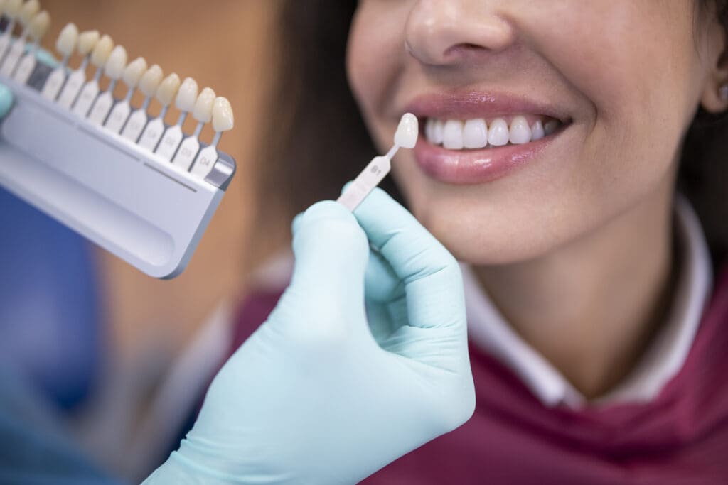 porcelain veneers fox lake il